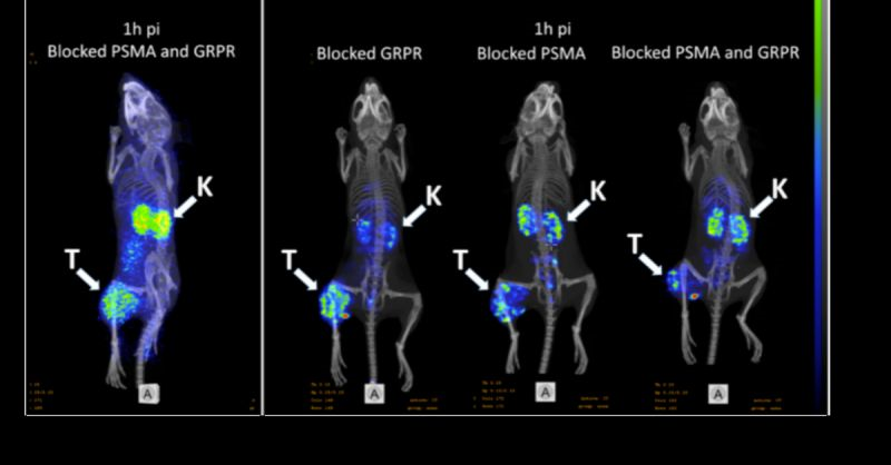 Doubling the targets for detecting prostate - doubling the imaging with PET and SPECT